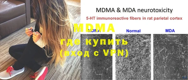 бошки Медвежьегорск